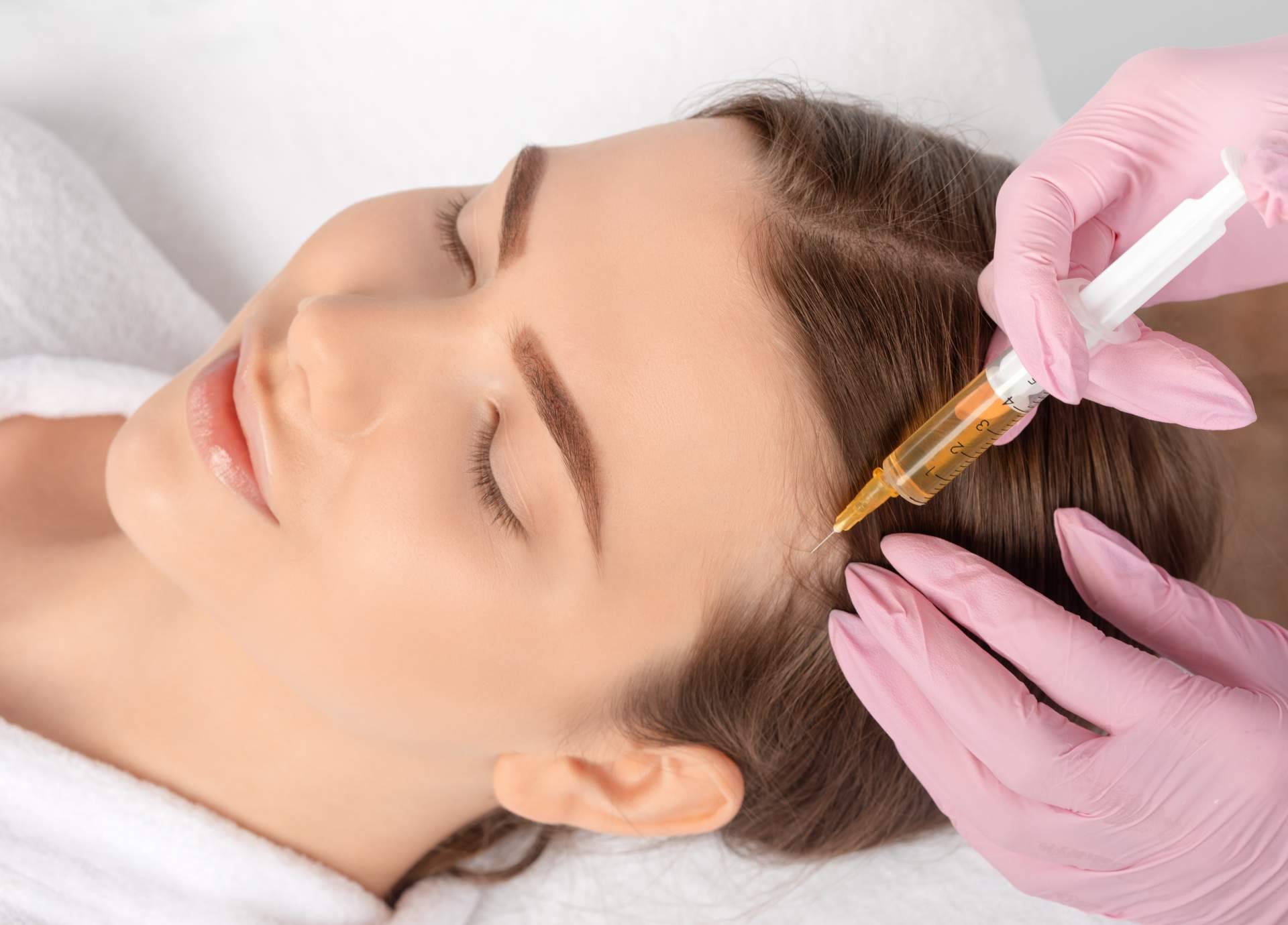 Plasma rico en plaquetas, mesoterapia capilar y vitaminas